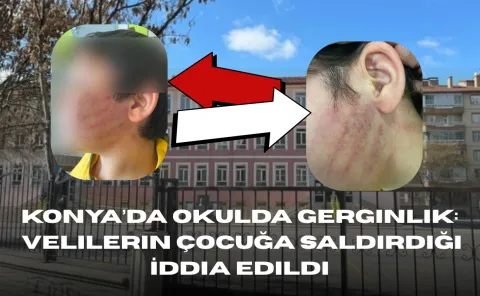 Konya’da Şoke Eden Olay! Veliler Çocuğa Saldırdı!