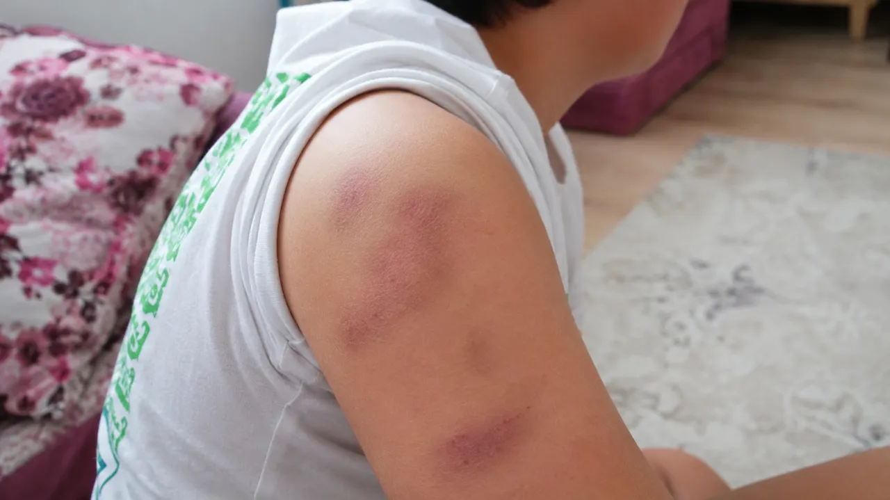 Konya Selçuklu’da ilkokul öğrencisine darp iddiası: Veliye şikâyet
