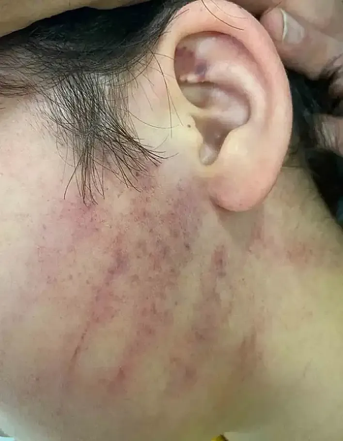 Konya’da Veli Dehşeti! 8 Yaşındaki Çocukları Darbettiler
