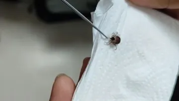 5 yaşındaki çocuğun kulağındaki ağrının nedeni şoke etti! Doktor canlı canlı çıkardı