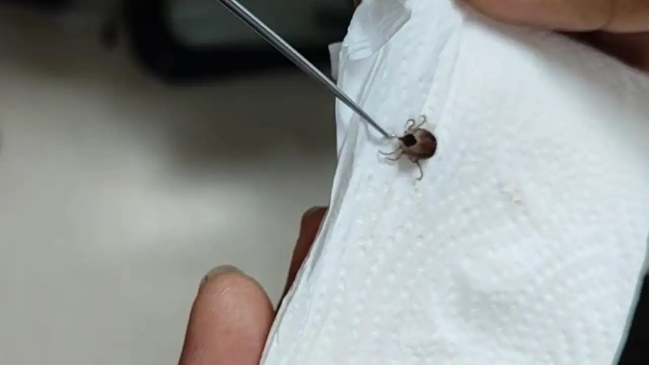 5 yaşındaki çocuğun kulağındaki ağrının nedeni şoke etti! Doktor canlı canlı çıkardı