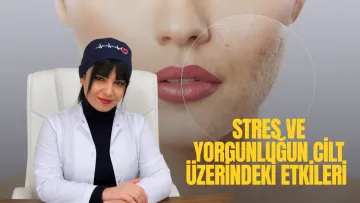Cildimiz Ne Anlatıyor? Stres ve Yorgunluğun Cilt Üzerindeki Etkileri