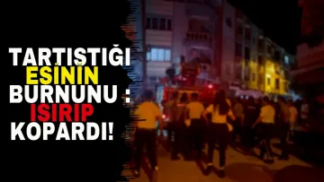Tartıştığı eşinin burnunu ısırıp kopardı! Şüpheli gözaltında
