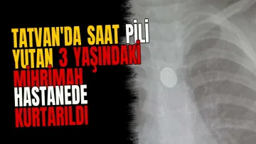 Tatvan'da Saat Pili Yutan 3 Yaşındaki Mihrimah Hastanede Kurtarıldı