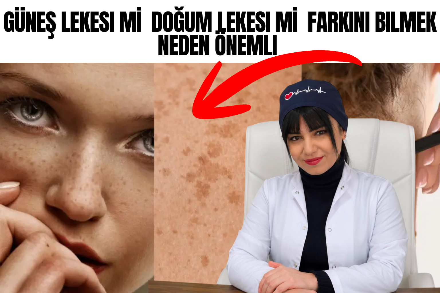 GÜNEŞ LEKESI Mİ DOĞUM LEKESI Mİ FARKINI BILMEK NEDEN ÖNEMLI